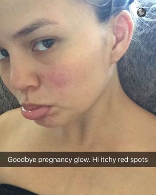 chrissy-teigen-says-goodbye-to-pregnancy-glow-with-makeup-free-photo